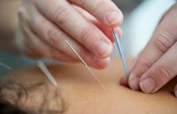 Acupunctuur bij angst werkt, en de wetenschap is duidelijk